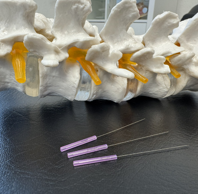 Akupunktur und Triggerpunkttherapie in der Privatpraxis von Dr. med. Karolin Stein in Berlin Treptow-Köpenick